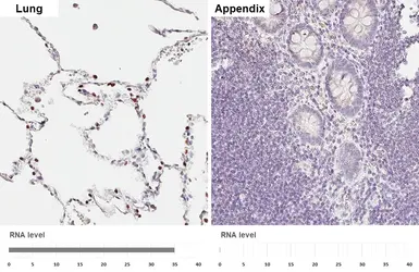 Anti-NKX2.1 antibody [HL6474] used in IHC (Paraffin sections) (IHC-P). GTX648922