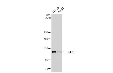 Anti-FAK antibody [HL6480] used in Western Blot (WB). GTX648928