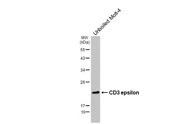 Anti-CD3 epsilon antibody [GT416] used in Western Blot (WB). GTX648937