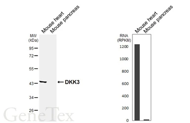 Anti-DKK3 antibody [HL6498] used in Western Blot (WB). GTX648954
