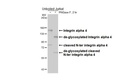 Anti-Integrin alpha 4 antibody [HL6500] used in Western Blot (WB). GTX648956
