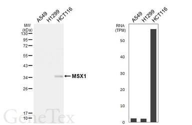 Anti-MSX1 antibody [HL6505] used in Western Blot (WB). GTX648961