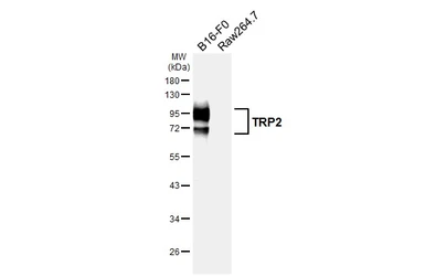 Anti-TRP2 antibody [HL6508] used in Western Blot (WB). GTX648964