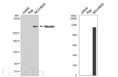 Anti-Nestin antibody [HL6512] used in Western Blot (WB). GTX648968