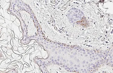 Anti-Laminin beta 3 antibody [HL6516] used in IHC (Paraffin sections) (IHC-P). GTX648972