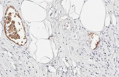 Anti-Hemoglobin beta antibody [HL6521] used in IHC (Paraffin sections) (IHC-P). GTX648977