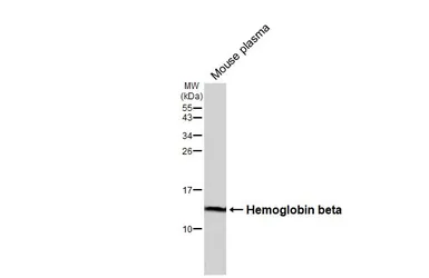 Anti-Hemoglobin beta antibody [HL6521] used in Western Blot (WB). GTX648977