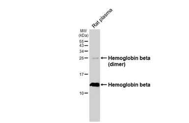 Anti-Hemoglobin beta antibody [HL6521] used in Western Blot (WB). GTX648977