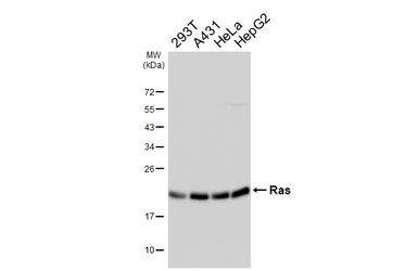 Anti-Ras antibody [HL6523] used in Western Blot (WB). GTX648979
