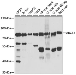 Anti-ABCB8 antibody used in Western Blot (WB). GTX64900