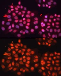Anti-ABCB8 antibody used in Immunocytochemistry/ Immunofluorescence (ICC/IF). GTX64900