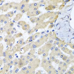 Anti-ABCB8 antibody used in IHC (Paraffin sections) (IHC-P). GTX64900