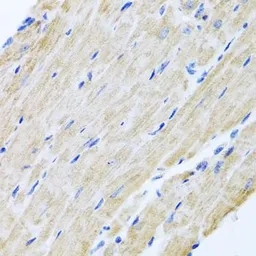 Anti-ABCB8 antibody used in IHC (Paraffin sections) (IHC-P). GTX64900