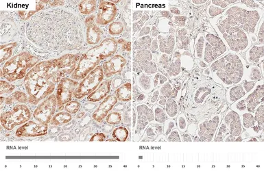 Anti-AMACR antibody [HL6548] used in IHC (Paraffin sections) (IHC-P). GTX649018