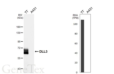 Anti-DLL3 antibody [HL6550] used in Western Blot (WB). GTX649020
