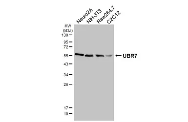 Anti-UBR7 antibody [HL6568] used in Western Blot (WB). GTX649038