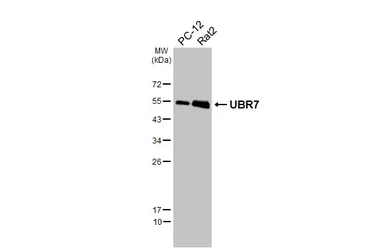 Anti-UBR7 antibody [HL6568] used in Western Blot (WB). GTX649038