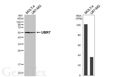 Anti-UBR7 antibody [HL6568] used in Western Blot (WB). GTX649038