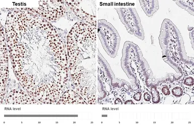 Anti-UBR7 antibody [HL6568] used in IHC (Paraffin sections) (IHC-P). GTX649038