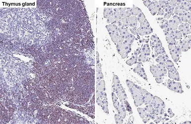 Anti-GFI1 antibody [HL6576] used in IHC (Paraffin sections) (IHC-P). GTX649046