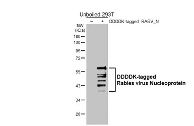 Anti-Rabies virus Nucleoprotein antibody [HL6590] used in Western Blot (WB). GTX649060