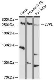 Anti-Envoplakin antibody used in Western Blot (WB). GTX64908