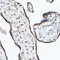 Anti-TRF41 antibody used in IHC (Paraffin sections) (IHC-P). GTX64928
