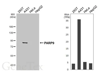 Anti-PARP9 antibody [HL6616] used in Western Blot (WB). GTX649316