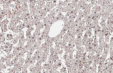 Anti-PARP9 antibody [HL6616] used in IHC (Paraffin sections) (IHC-P). GTX649316