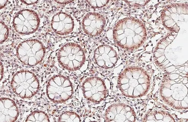 Anti-PARP9 antibody [HL6616] used in IHC (Paraffin sections) (IHC-P). GTX649316