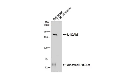 Anti-L1CAM antibody [HL6618] used in Western Blot (WB). GTX649318