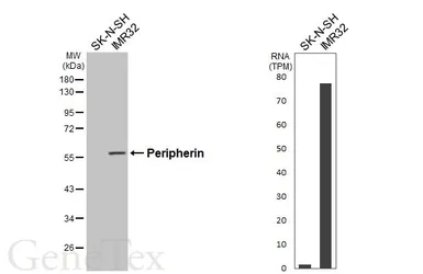 Anti-Peripherin antibody [HL6621] used in Western Blot (WB). GTX649321