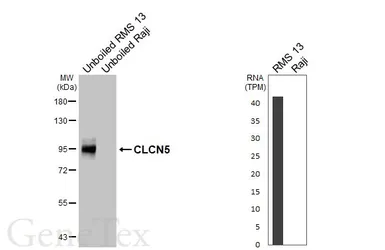 Anti-CLCN5 antibody [HL6625] used in Western Blot (WB). GTX649325