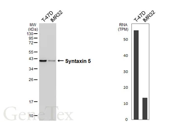 Anti-Syntaxin 5 antibody [HL6629] used in Western Blot (WB). GTX649329