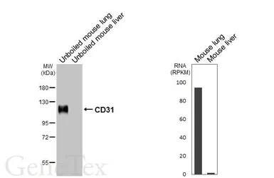 Anti-CD31 antibody [HL6650] used in Western Blot (WB). GTX649359