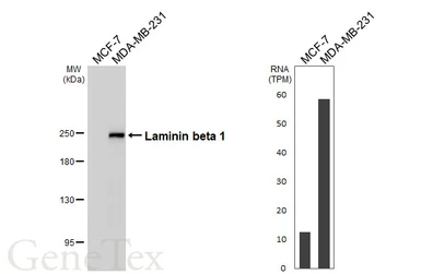 Anti-Laminin beta 1 antibody [HL6655] used in Western Blot (WB). GTX649364