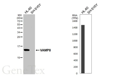 Anti-VAMP8 antibody [HL6688] used in Western Blot (WB). GTX649399