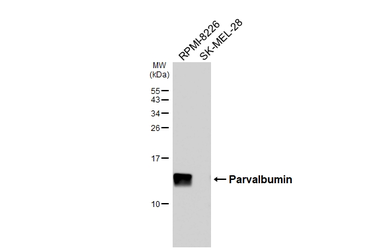 Anti-Parvalbumin antibody [HL6691] used in Western Blot (WB). GTX649402