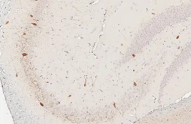 Anti-Parvalbumin antibody [HL6691] used in IHC (Paraffin sections) (IHC-P). GTX649402
