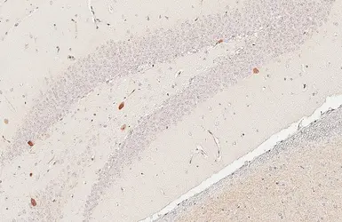 Anti-Parvalbumin antibody [HL6691] used in IHC (Paraffin sections) (IHC-P). GTX649402