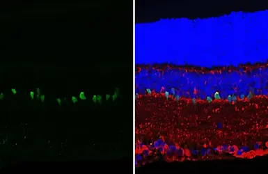 Anti-Parvalbumin antibody [HL6691] used in IHC (Paraffin sections) (IHC-P). GTX649402