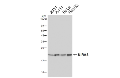 Anti-N-RAS antibody [HL6708] used in Western Blot (WB). GTX649419
