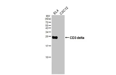 Anti-CD3 delta antibody [HL6744] used in Western Blot (WB). GTX649467