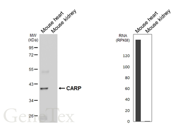 Anti-CARP antibody [GT437] used in Western Blot (WB). GTX649486