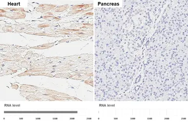 Anti-CARP antibody [GT437] used in IHC (Paraffin sections) (IHC-P). GTX649486