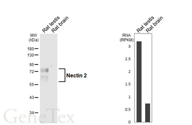 Anti-Nectin 2 antibody [GT439] used in Western Blot (WB). GTX649488