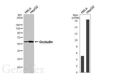 Anti-Occludin antibody [GT441] used in Western Blot (WB). GTX649490