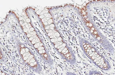 Anti-MAN2A1 antibody [HL6777] used in IHC (Paraffin sections) (IHC-P). GTX649508