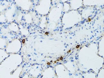 Anti-TEFM antibody used in IHC (Paraffin sections) (IHC-P). GTX64957