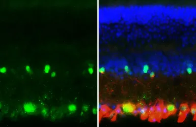 Anti-Parvalbumin antibody [HL6815] used in IHC (Frozen sections) (IHC-Fr). GTX649629